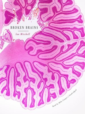 cover image of Broken Brains